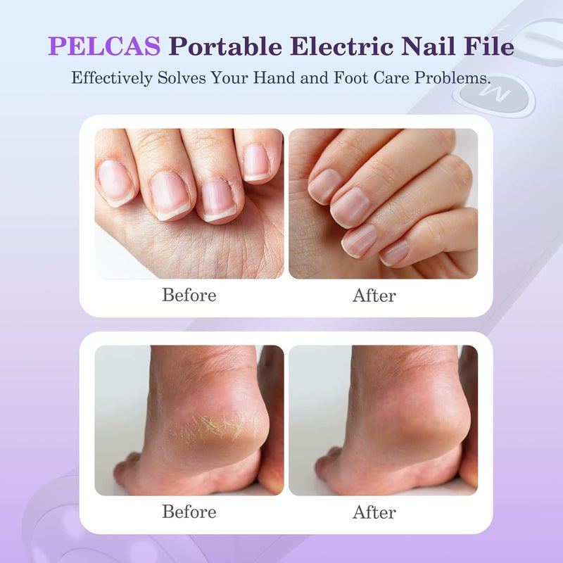 PELCAS Electric Nail Drills, 10 Speeds Cordless Nail File with LED Light, Portable Manicure & Pedicure Kit, Nail Grinder with LCD Screen for Human, Pet, Thick Toenails, Natural & Acrylic Nails Purple - Image 2